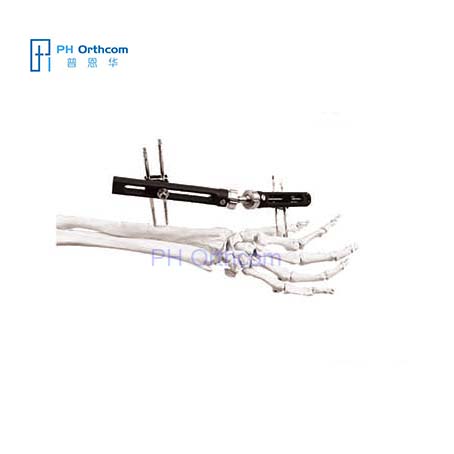 Penning Wrist Fixator(PEEK) For Distal Radius Fragment Orthofix Types External Fixation System