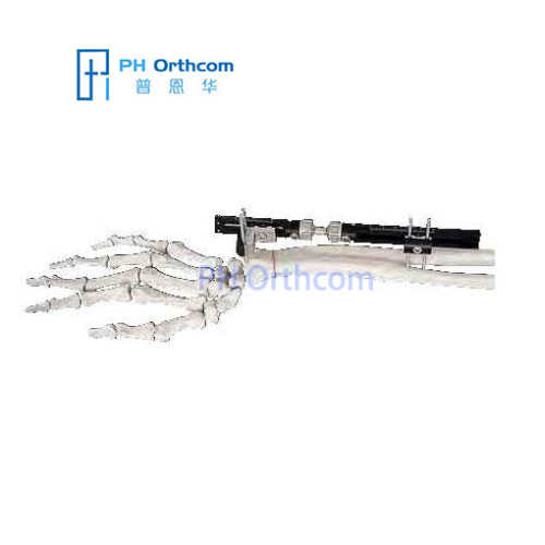 Dynamic Wrist External Fixator For Extra-articular Fractures&Corrective Osteotomies Orthofix Type Fixator-0 Dynamic Wrist External Fixator For Extra-articular Fractures&Corrective Osteotomies Orthofix Type Fixator