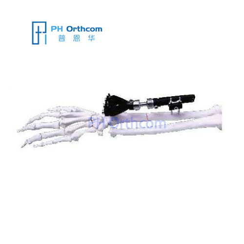 Extra-articular Radiolucent Wrist External Fixator Orthofix Type Fixators Trauma Orthopaedic-0 Extra-articular Radiolucent Wrist External Fixator Orthofix Type Fixators Trauma Orthopaedic