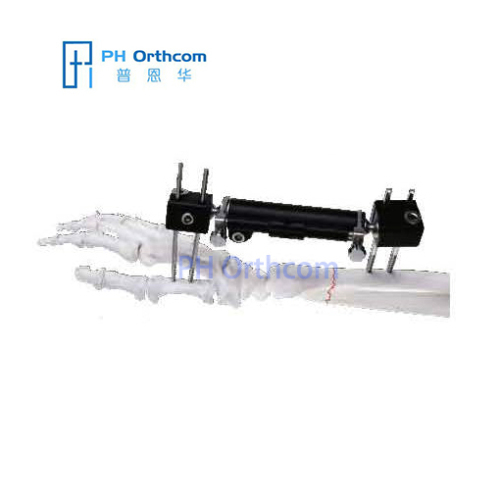 Radiolucent Wrist External Fixator Orthofix Fixator Modular System Trauma Orthopaedic External Fixator
