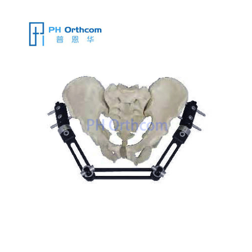Long Pelvic External Fixator With ProCallus Straight Clamps Orthofix Type Orthopedic-0 Long Pelvic External Fixator With ProCallus Straight Clamps Orthofix Type Orthopedic