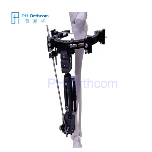 Hybrid Ring Fixator(PEEK) Orthofix Type External Fixator Surgical External Fixator-1 Hybrid Ring Fixator(PEEK) Orthofix Type External Fixator Surgical External Fixator