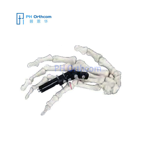 MiniRail External Fixator Articulation In Vertical Axis Orthofix Type Mini Fragments Fixator Trauma Orthopeadic-0 MiniRail External Fixator Articulation In Vertical Axis Orthofix Type Mini Fragments Fixator Trauma Orthopeadic