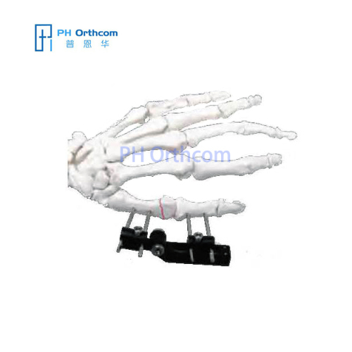 MiniRail Fixator Articulation In Horizontal Axis Orthofix Type Mini Fragments Finger Fixator Trauma Orthopedic-0 MiniRail Fixator Articulation In Horizontal Axis Orthofix Type Mini Fragments Finger Fixator Trauma Orthopedic
