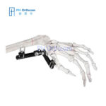 Multiplanar Minirail External Fixator Orthofix Type Mini Fragement Finger External Fixator Trauma Orthopaedic