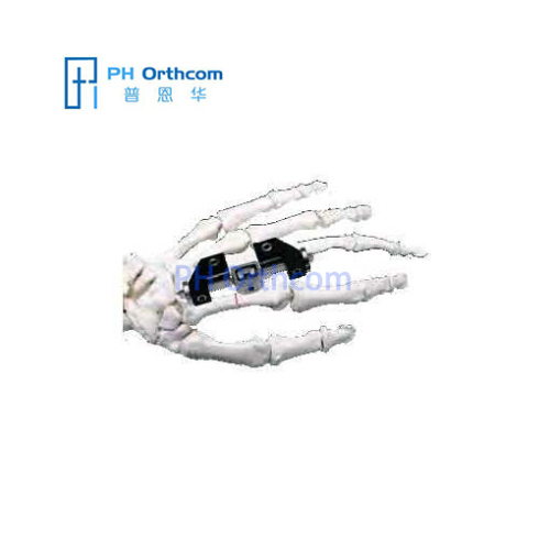 Penning Mini Exteranal Fixator With L-Clamp Orthofix System Mini Fragment Finger External Fixator Trauma Orthopedic