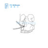 Instrument For The Cranio-Maxillofacial Surgery Orthopaedic Instrument Nasal Septum Osteotomes-1 Instrument For The Cranio-Maxillofacial Surgery Orthopaedic Instrument Nasal Septum Osteotomes