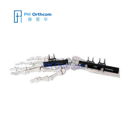 Penning Dynamic Wrist Fixator With Compression-Distraction Module Orthofix Type Trauma Orthopedic