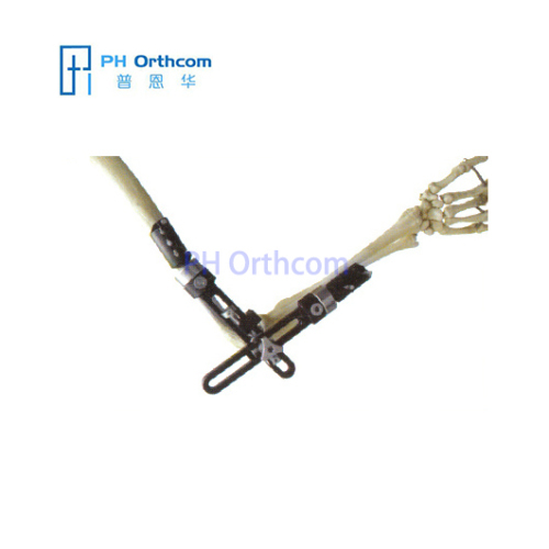 Elbow External Fixator Orthofix Type External Fixator Trauma Orthopaedic-0 Elbow External Fixator Orthofix Type External Fixator Trauma Orthopaedic