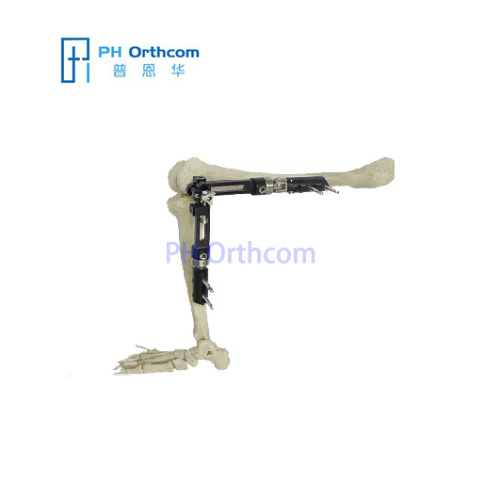 Knee Fixator With ProCallus Straight Clamps Orthofix Type Trauma Orthopaedic-0 Knee Fixator With ProCallus Straight Clamps Orthofix Type Trauma Orthopaedic